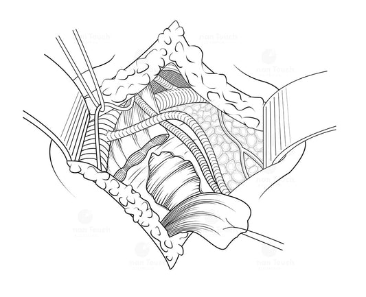 What Makes a Good Surgical Illustration?
