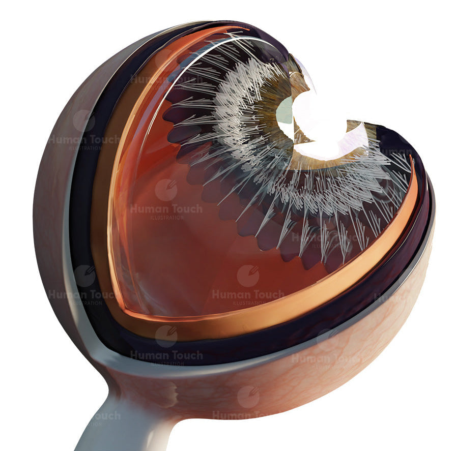3D medical model of the eyeball, a cut section showing layers of the eye, and the anatomy holding the iris in place. Displayed on a white background.