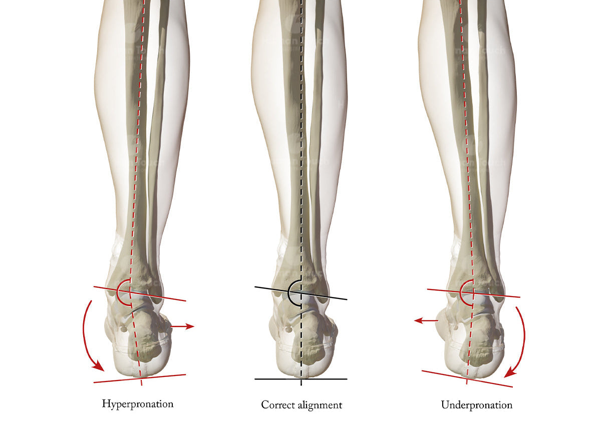 Anatomical illustration using 3D model of correct and incorrect foot alignment with labelled parts.