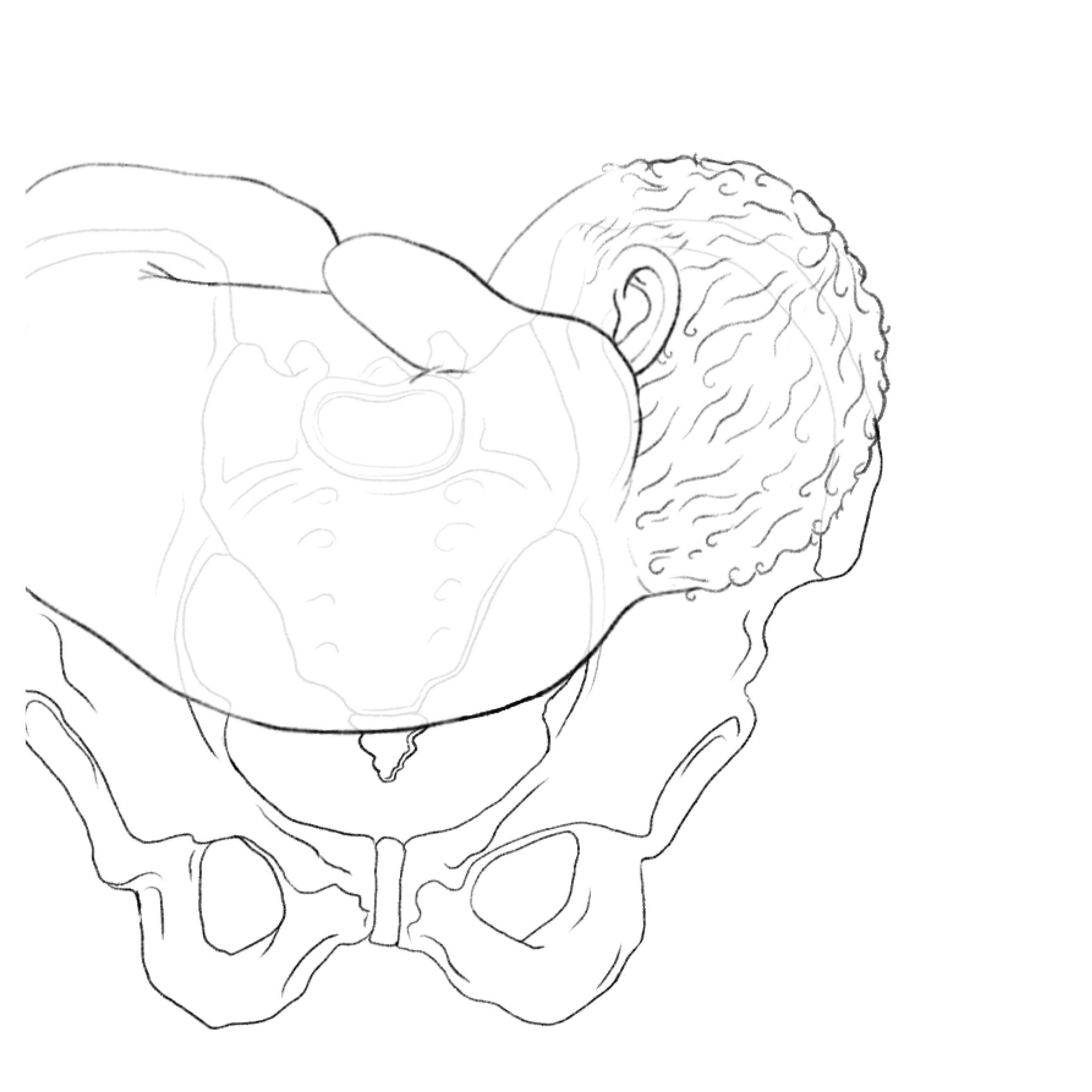 Pencil line drawing of a fetus in transverse lie in a pelvis for medical text books or teaching